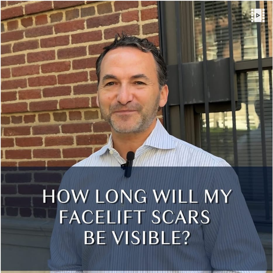 How long will your facelift scars be