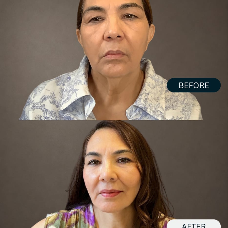 A refreshed, more defined look, while
