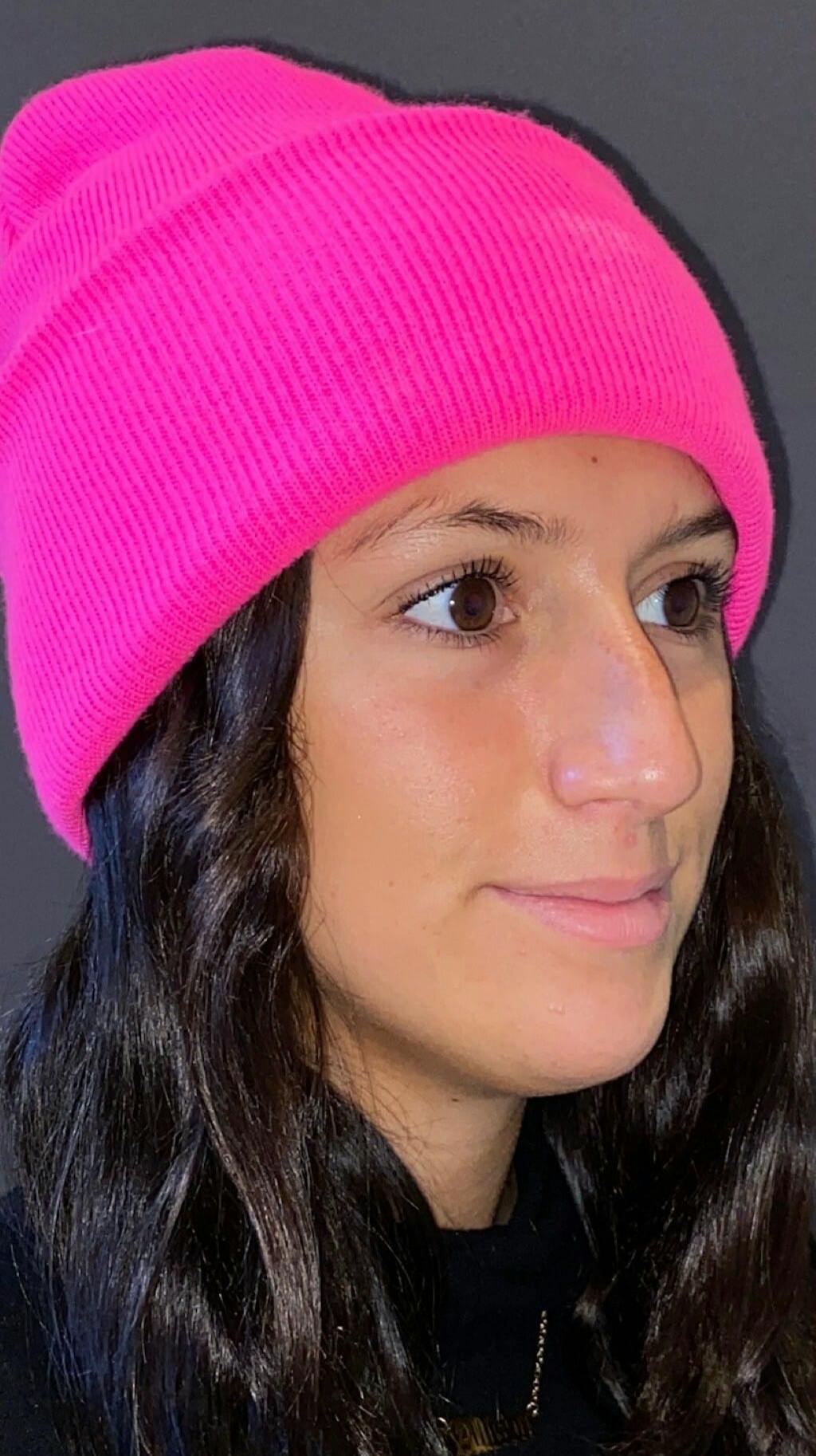 Rhinoplasty Before & After Gallery - Patient 151510791 - Image 3
