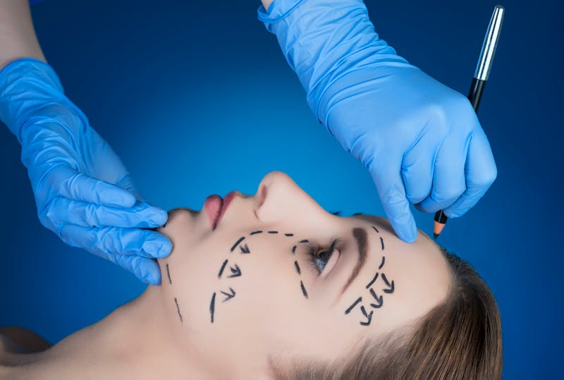 Woman preparing for a facelift