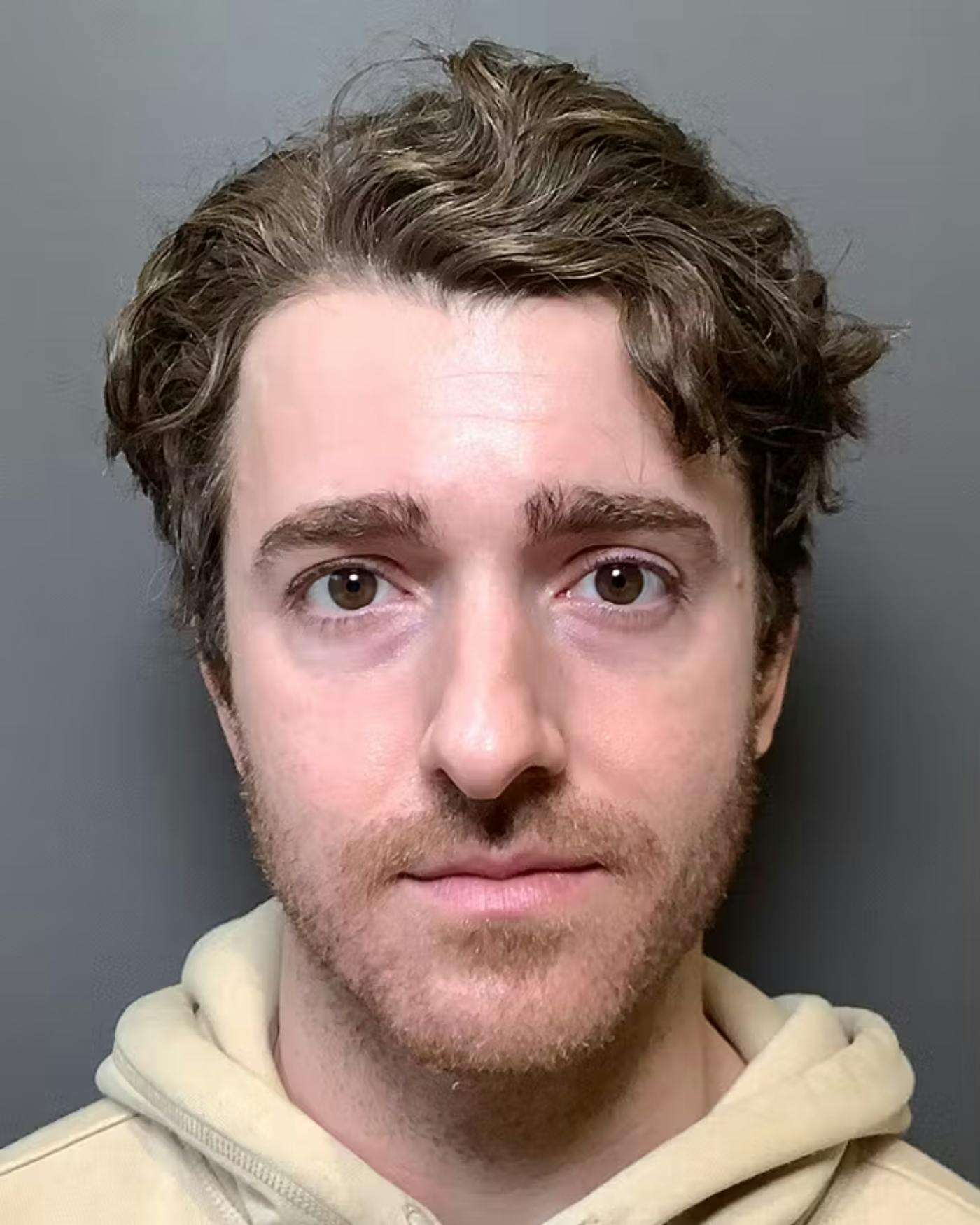Rhinoplasty Before & After Gallery - Patient 422489 - Image 5