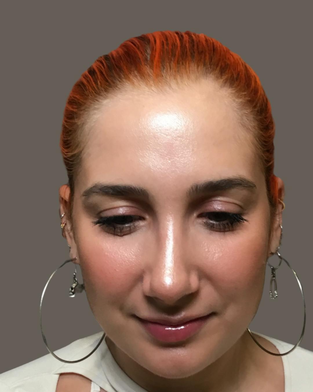 Rhinoplasty Before & After Gallery - Patient 143120 - Image 12