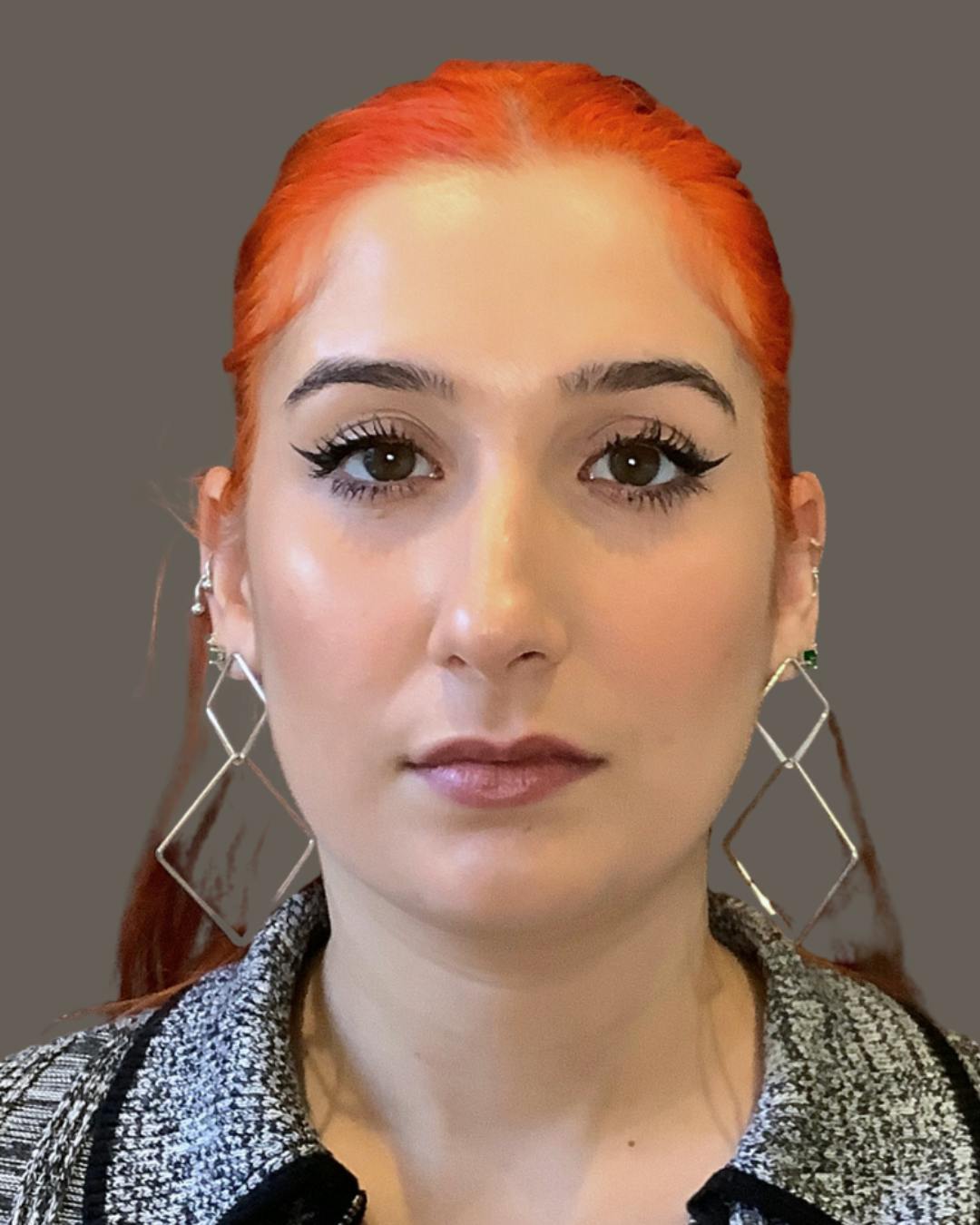 Rhinoplasty Before & After Gallery - Patient 143120 - Image 5