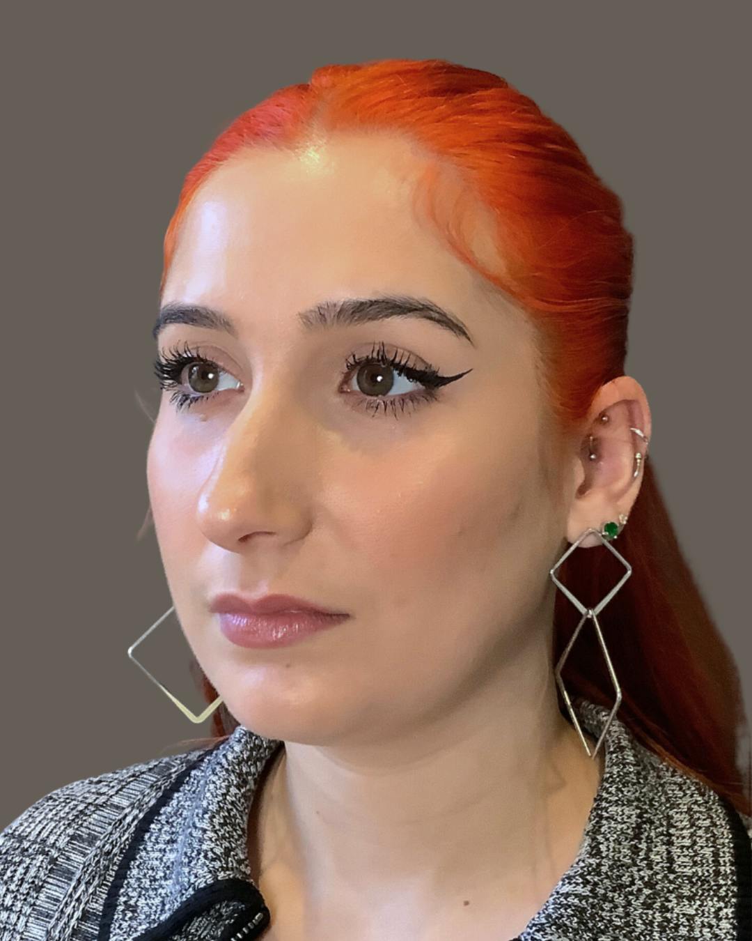 Rhinoplasty Before & After Gallery - Patient 143120 - Image 7
